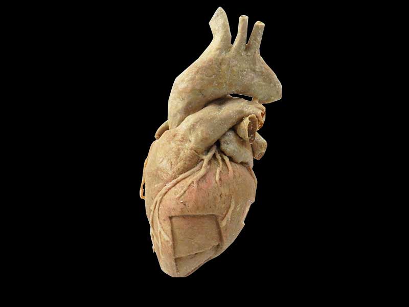 cardiac muscle plastinated specimen