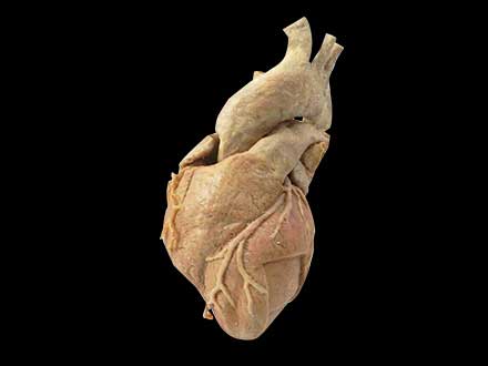 cardiac muscle plastinated specimen