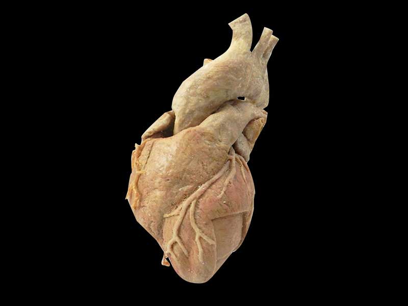 cardiac muscle plastination specimen