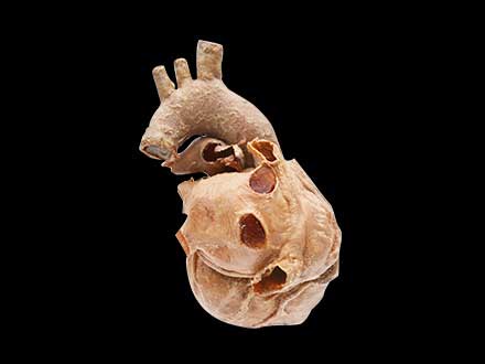 Cardiovascular plastianted specimen