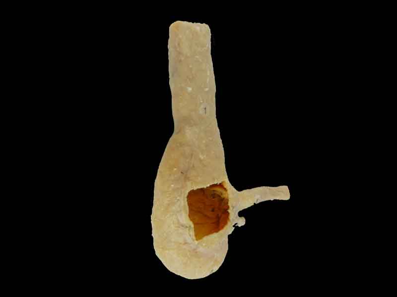 Cecum ileum and appendix plastination