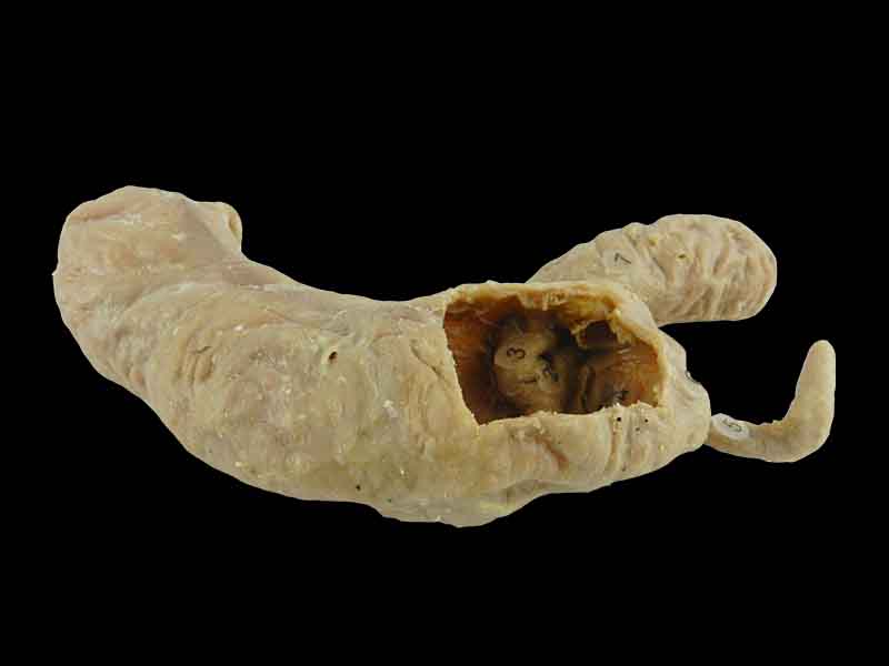 Cecum ileum and appendix specimen for sale