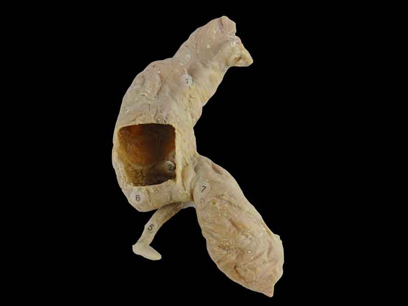 Cecum ileum and appendix teaching specimen