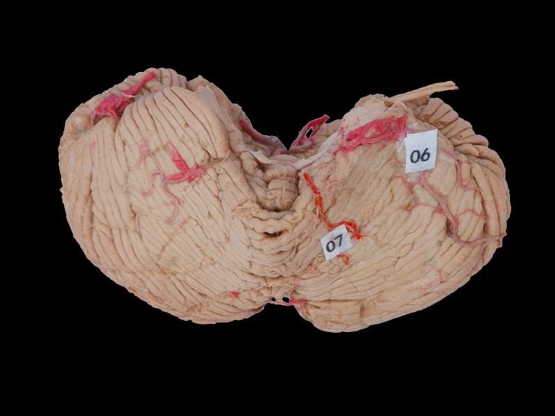 cerebellar artery plastination specimen