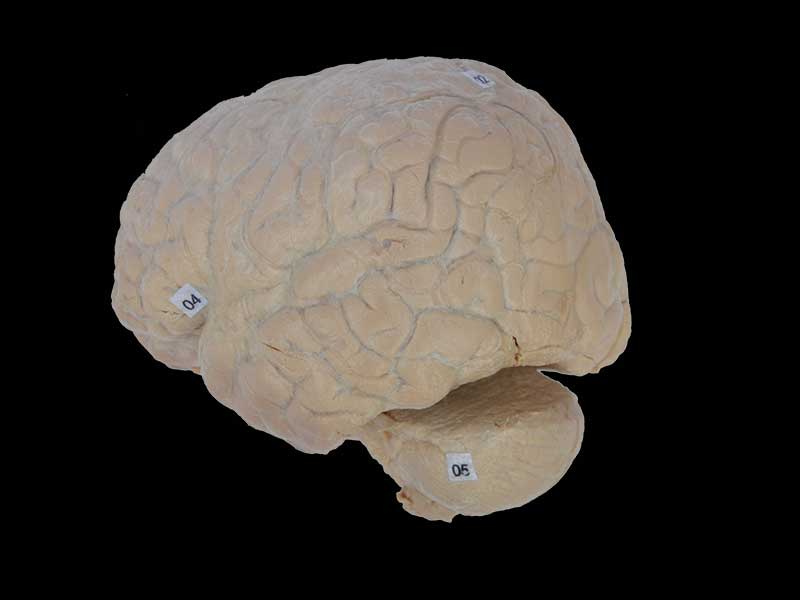 cerebral arachnoid mater
