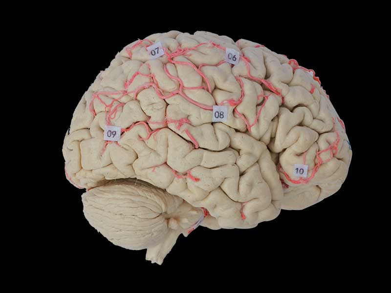cerebral artery plastinated specimen
