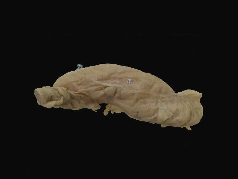 Colon Form plastinated specimens (medical specimens for sale)