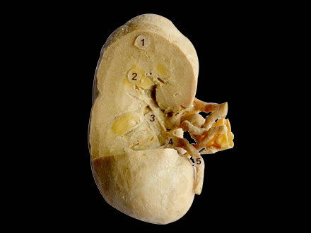coronal section of kidney 3 quaters human body plastination