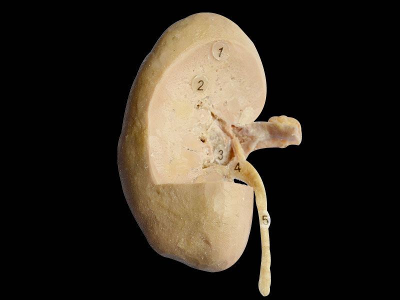 coronal section of kidney 3 quaters plastinated specimen