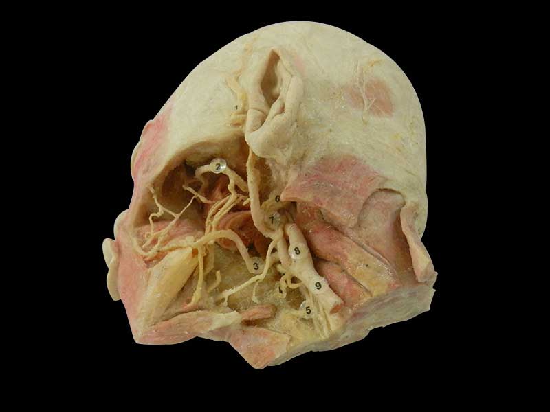 Deep vascular nerve of head and face plastination