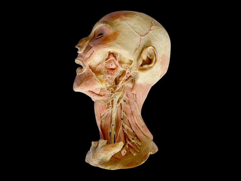 Deep vascular nerve of head and neck plastination