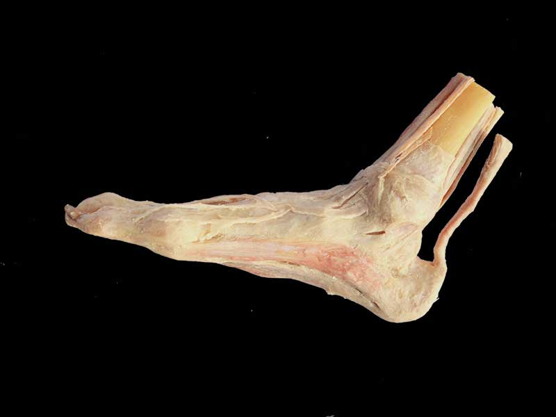 Dorsalis pedis vein plastination specimen