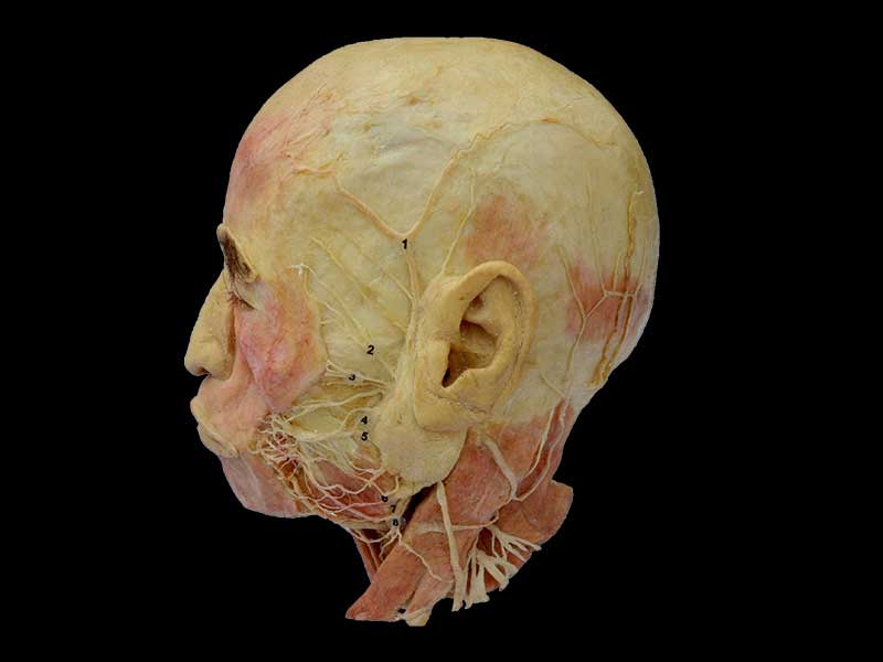 Facial nerve plastinated specimen