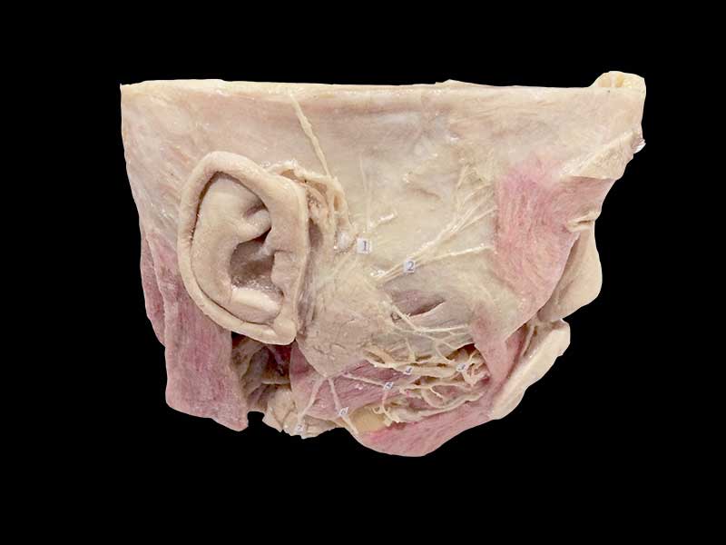 facial nerves and branches plastination