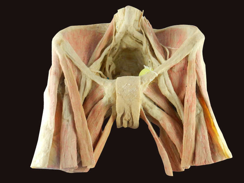 Female pelvic organs human body plastination,male pelvis medical teaching model, medical specimens