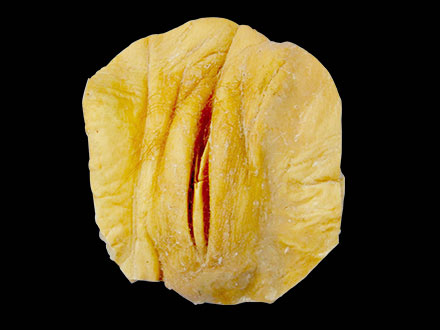 female pudenda human body plastination