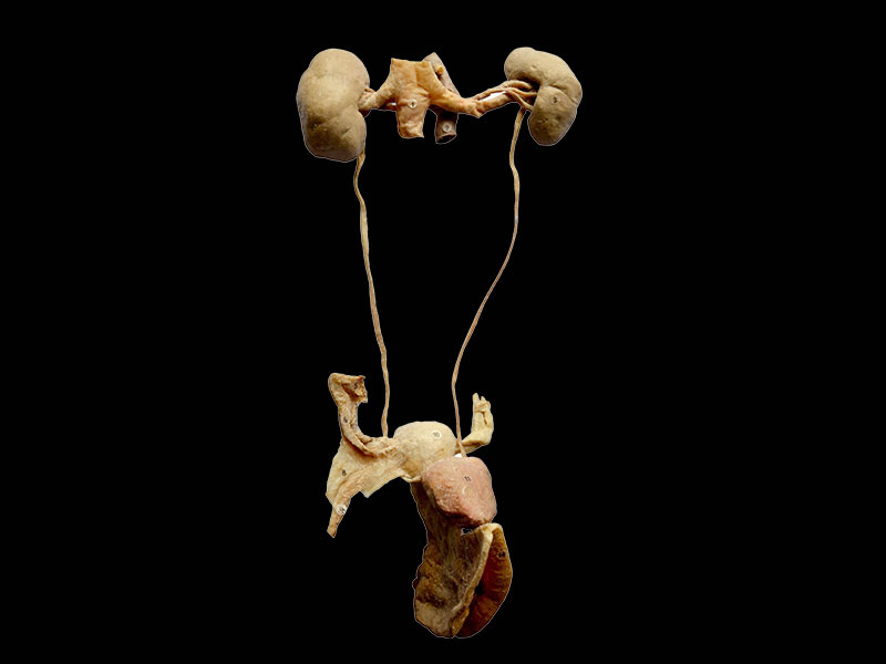 Female urogenital system plastinated organs,male pelvis ...