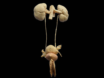 female urogenital system plastinated organs