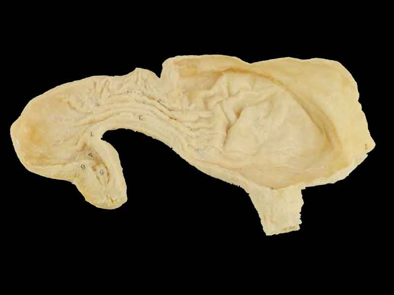 Gastric mucosa plastinated specimen