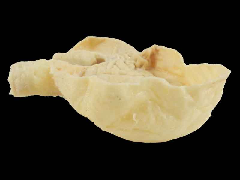 Gastric mucosa specimen for sale
