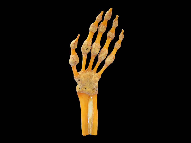 hand joint plastinated specimen
