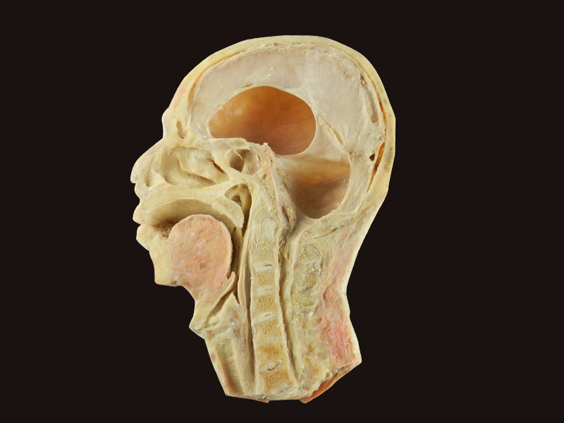 head and neck sagittal section plastination