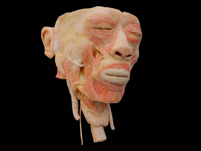 head with pharynx specimen