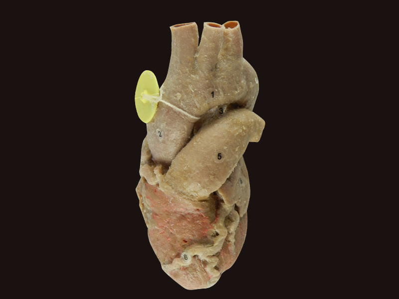 Heart with coronary vessels plastinated specimen