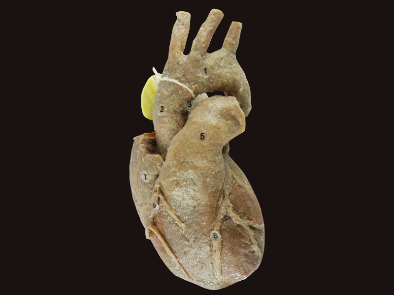 Heart with coronary vessels specimen for sale