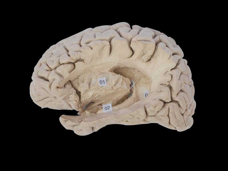 Hippocampal formation plastinated specimen