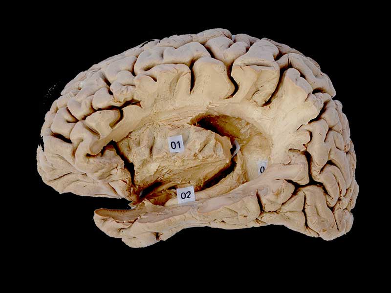 Hippocampal formation