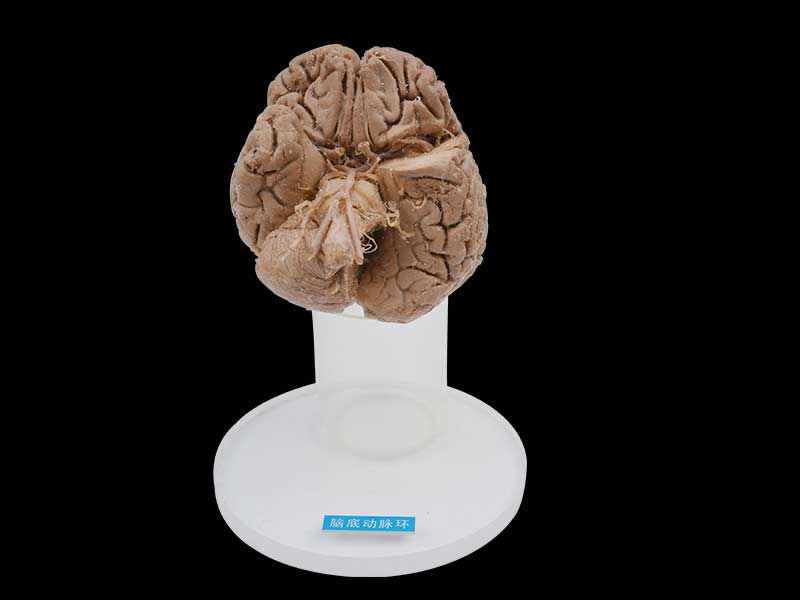 Human arteries of base of brain plastinated specimen