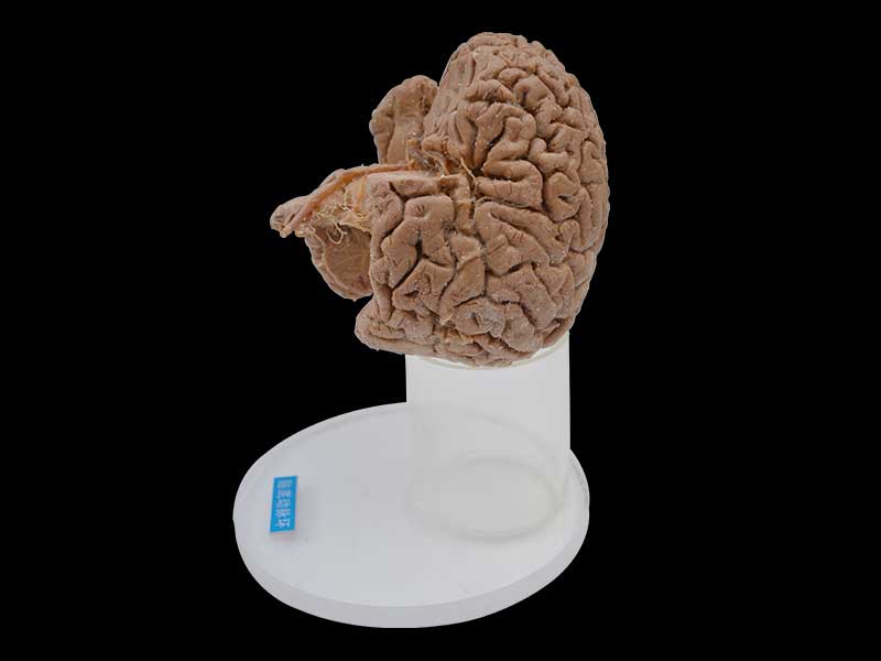 Human arteries of base of brain