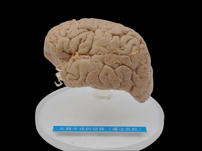 Human artery of cerebral hemisphere plastinated specimen