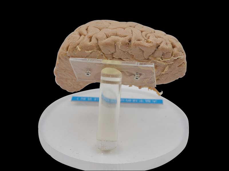 Human artery of cerebral hemisphere