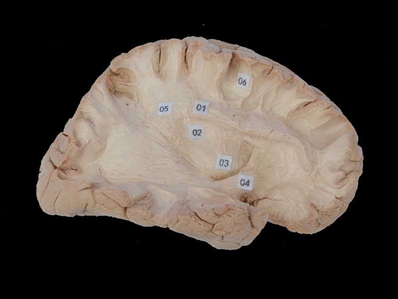 Human association fiber of cerebral hemisphere plastination