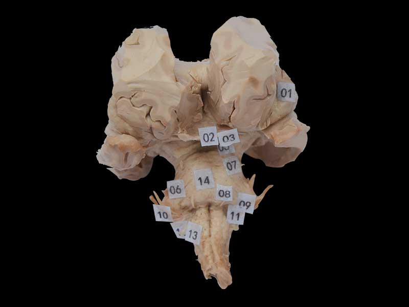 Human brain stem plastinated specimen