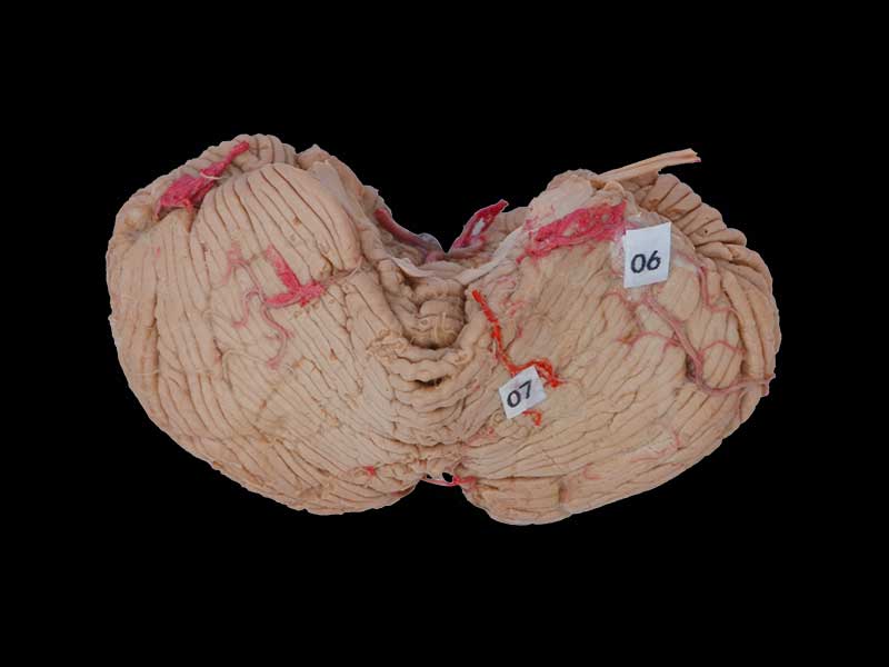 Human cerebellar artery plastinated specimen