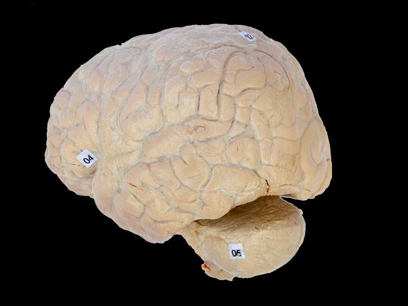 Human cerebral arachnoid mater plastination specimen
