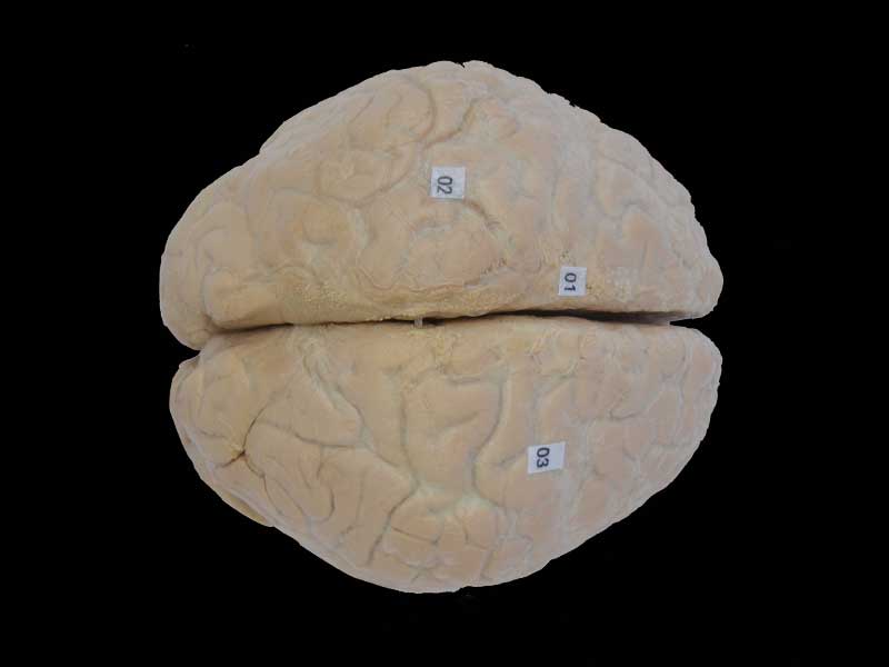 Human cerebral arachnoid mater