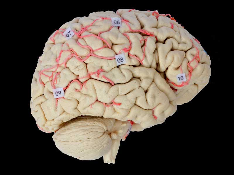 Human cerebral artery plastination