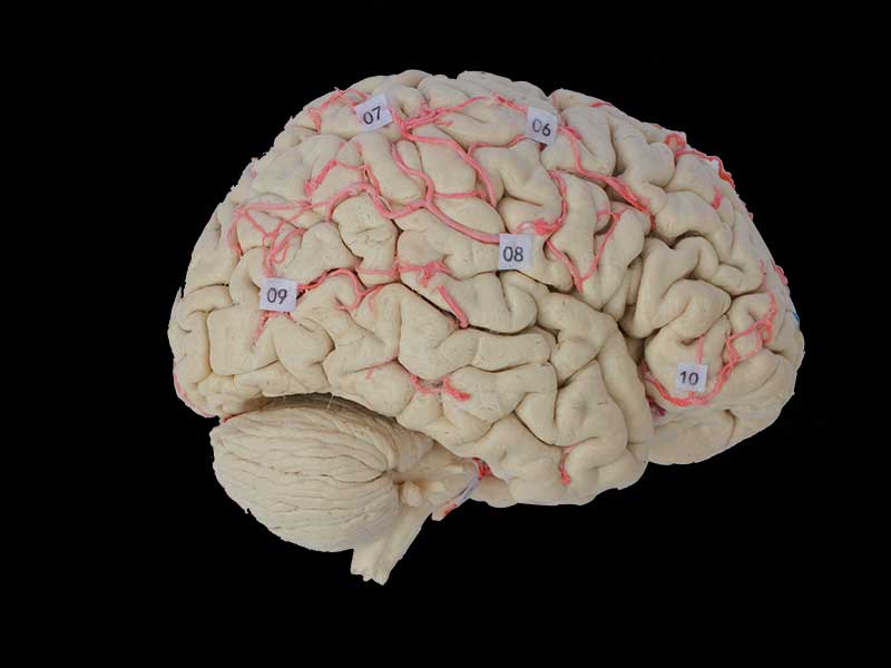 Human cerebral artery