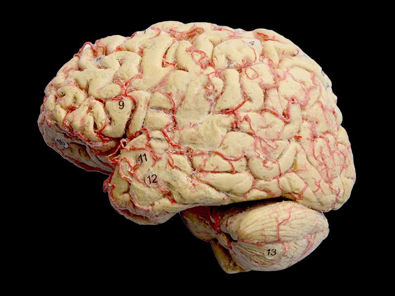 Human cerebral hemisphere and brain stem