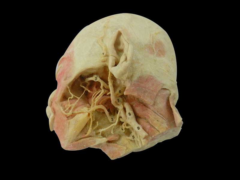 Human deep vascular nerve of head and face plastination