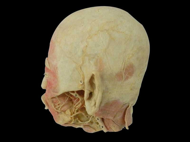 Human deep vascular nerve of head and neck and face