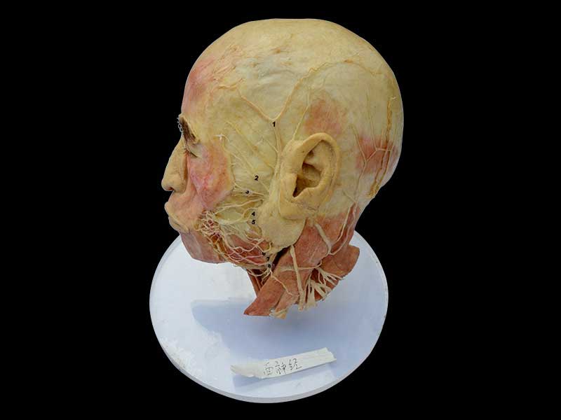 Human facial nerve plastinated specimen