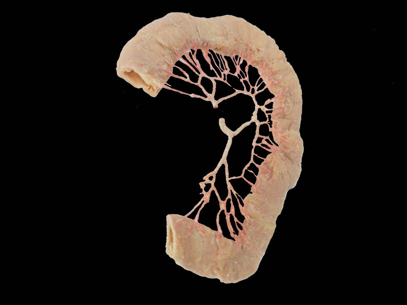 human ileal vascular arch
