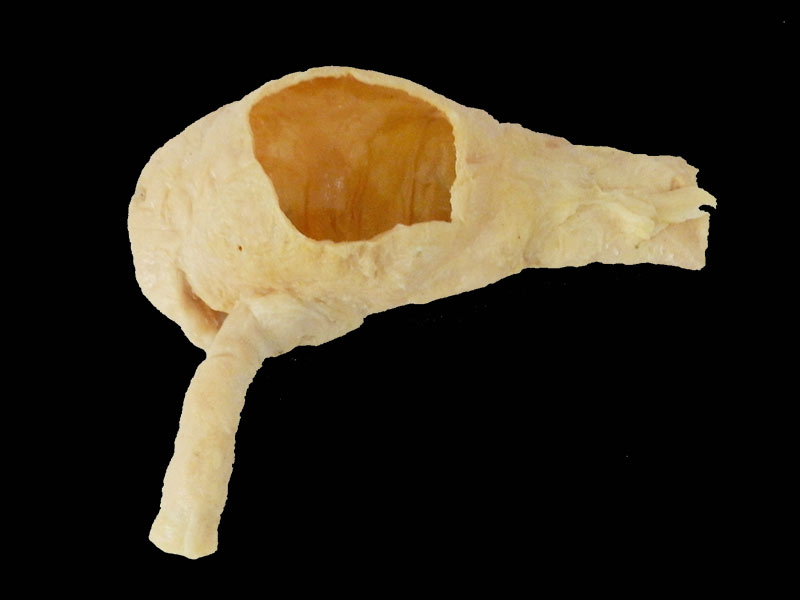 human ileocecal junction specimen