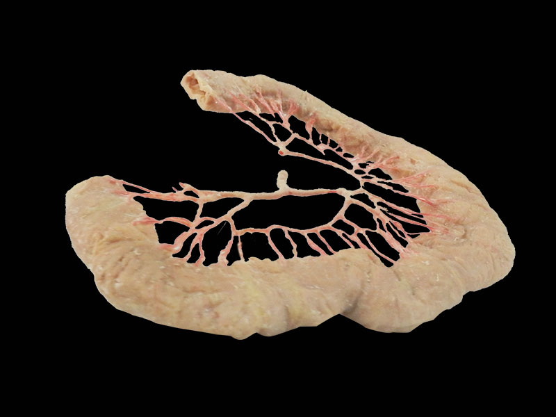 human jejunal vascular arch specimen