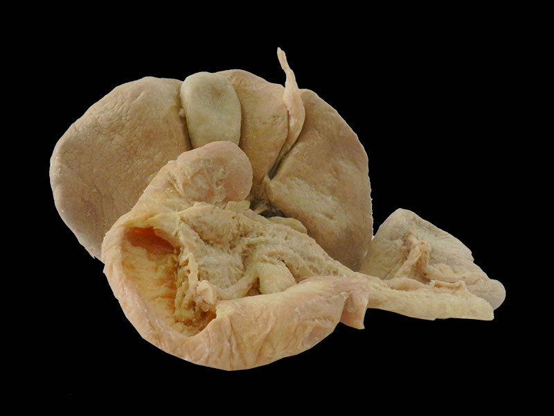 human liver pancreas duodenum spleen